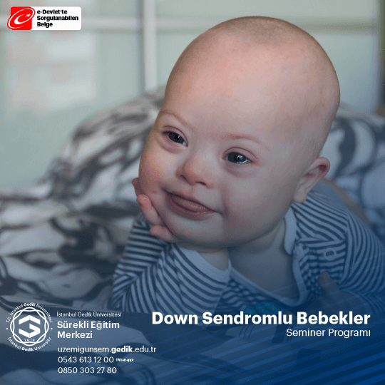 Down Senromlu Bebekler